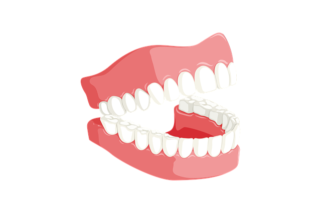 what are implant supported dentures